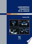 Libro Cardiopatías Congénitas en el Adulto