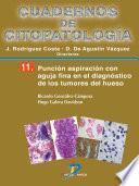Libro Punción aspiración con aguja fina en el diagnóstico de los tumores de hueso